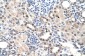 RORA antibody - middle region
